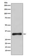 Emerin antibody, M00714-1, Boster Biological Technology, Western Blot image 