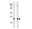 CD9 Molecule antibody, F44204-0.4ML, NSJ Bioreagents, Western Blot image 