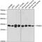 Proteasome Activator Subunit 2 antibody, 19-734, ProSci, Western Blot image 