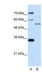 Zinc Finger Protein 707 antibody, NBP1-80430, Novus Biologicals, Western Blot image 