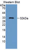 BAF Chromatin Remodeling Complex Subunit BCL11A antibody, LS-C373281, Lifespan Biosciences, Western Blot image 