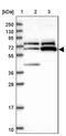 Zinc Finger Protein 329 antibody, PA5-60693, Invitrogen Antibodies, Western Blot image 