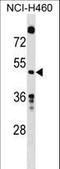 Guanine Deaminase antibody, LS-C166420, Lifespan Biosciences, Western Blot image 