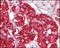 Serine/Threonine/Tyrosine Kinase 1 antibody, NBP1-47511, Novus Biologicals, Immunohistochemistry frozen image 