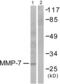 Matrix Metallopeptidase 7 antibody, abx013150, Abbexa, Western Blot image 