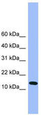 ATP Synthase F1 Subunit Delta antibody, TA337647, Origene, Western Blot image 