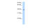 Distal-Less Homeobox 5 antibody, 27-728, ProSci, Western Blot image 