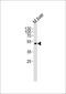 Platelet Derived Growth Factor D antibody, MBS9202914, MyBioSource, Western Blot image 