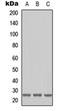 RAB41, Member RAS Oncogene Family antibody, orb304538, Biorbyt, Western Blot image 