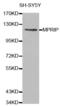 Myosin Phosphatase Rho Interacting Protein antibody, abx000805, Abbexa, Western Blot image 