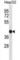 Short Chain Dehydrogenase/Reductase Family 16C Member 5 antibody, abx028397, Abbexa, Western Blot image 