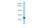 RING finger protein unkempt-like antibody, A13739, Boster Biological Technology, Western Blot image 