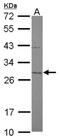 Mitochondrial Translational Initiation Factor 3 antibody, NBP2-17297, Novus Biologicals, Western Blot image 