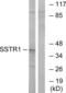 Somatostatin Receptor 1 antibody, abx015477, Abbexa, Western Blot image 