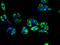 Transmembrane Protein 31 antibody, A63636-100, Epigentek, Immunofluorescence image 