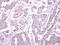 Zinc Finger And BTB Domain Containing 24 antibody, PA5-28068, Invitrogen Antibodies, Immunohistochemistry paraffin image 