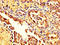 Moesin antibody, LS-C670690, Lifespan Biosciences, Immunohistochemistry paraffin image 