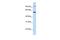 Transportin 2 antibody, GTX45353, GeneTex, Western Blot image 