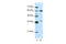 Heterogeneous Nuclear Ribonucleoprotein L antibody, 29-275, ProSci, Western Blot image 