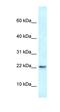 RNA Binding Motif Protein 3 antibody, orb330110, Biorbyt, Western Blot image 