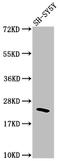 Ras Homolog Family Member A antibody, CSB-RA898030A0HU, Cusabio, Western Blot image 