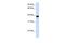 Forkhead Box E1 antibody, PA5-40422, Invitrogen Antibodies, Western Blot image 