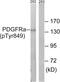 Platelet Derived Growth Factor Receptor Alpha antibody, LS-C199423, Lifespan Biosciences, Western Blot image 