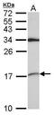 Small Nuclear Ribonucleoprotein D2 Polypeptide antibody, GTX101846, GeneTex, Western Blot image 