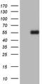 Plasminogen Activator, Urokinase antibody, NBP2-46436, Novus Biologicals, Western Blot image 