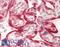Glypican 3 antibody, LS-B13373, Lifespan Biosciences, Immunohistochemistry paraffin image 