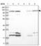 Ribophorin II antibody, NBP2-38323, Novus Biologicals, Western Blot image 