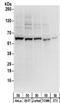 Zinc Finger Protein 622 antibody, NBP2-32087, Novus Biologicals, Western Blot image 