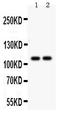 ATPase Sarcoplasmic/Endoplasmic Reticulum Ca2+ Transporting 1 antibody, LS-C357602, Lifespan Biosciences, Western Blot image 