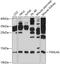 Thioredoxin-like U5 snRNP protein U5-15kD antibody, A08434, Boster Biological Technology, Western Blot image 