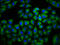 Adenylate Cyclase 6 antibody, LS-C671478, Lifespan Biosciences, Immunofluorescence image 