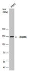 BUB1 Mitotic Checkpoint Serine/Threonine Kinase B antibody, GTX111289, GeneTex, Western Blot image 