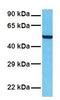 Solute Carrier Family 12 Member 1 antibody, GTX47166, GeneTex, Western Blot image 