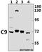 Complement C9 antibody, A01010, Boster Biological Technology, Western Blot image 