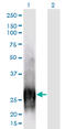 Calbindin 1 antibody, LS-C196804, Lifespan Biosciences, Western Blot image 