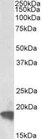 ADP Ribosylation Factor 4 antibody, TA311212, Origene, Western Blot image 