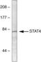 Signal Transducer And Activator Of Transcription 4 antibody, GTX10630, GeneTex, Western Blot image 