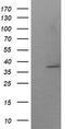 SUMO1 Activating Enzyme Subunit 1 antibody, CF506071, Origene, Western Blot image 