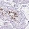 Zinc Finger Protein 568 antibody, HPA052061, Atlas Antibodies, Immunohistochemistry frozen image 