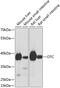 Ornithine Carbamoyltransferase antibody, 23-932, ProSci, Western Blot image 