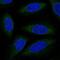 ALG6 Alpha-1,3-Glucosyltransferase antibody, NBP2-56400, Novus Biologicals, Immunocytochemistry image 