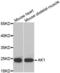 Adenylate Kinase 1 antibody, abx001130, Abbexa, Western Blot image 