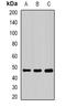 Phosphatidylinositol-5-Phosphate 4-Kinase Type 2 Beta antibody, orb341422, Biorbyt, Western Blot image 