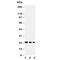 TNF Superfamily Member 13b antibody, R30618, NSJ Bioreagents, Western Blot image 