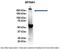 Spectrin Alpha, Non-Erythrocytic 1 antibody, ARP58532_P050, Aviva Systems Biology, Immunoprecipitation image 
