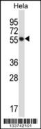 C-Terminal Src Kinase antibody, 57-242, ProSci, Western Blot image 